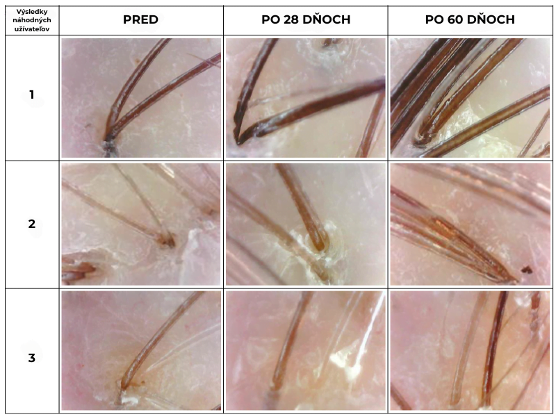 SK Collagen article image hair before after (1)