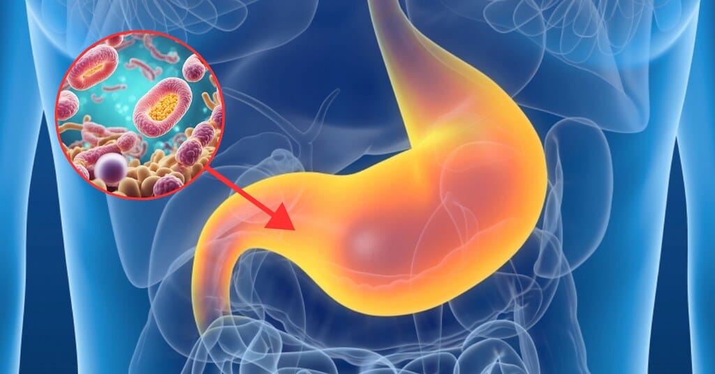 MicroTotal COMPLET + Sugar Control