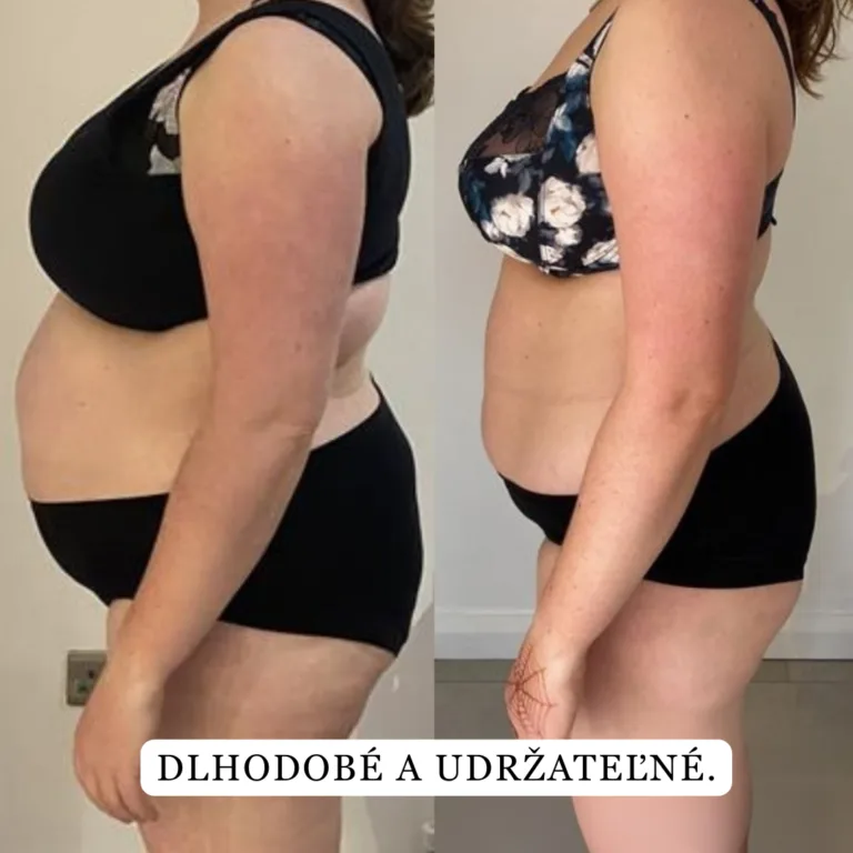 brand slimis bonboni za hujsanje lp 1 safe
