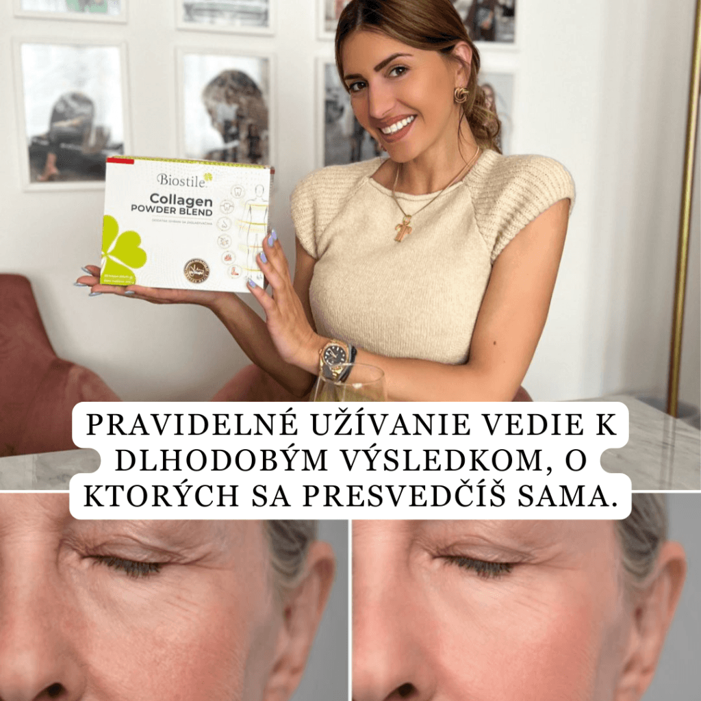 brand collagen s hialuronsko kislino darilo shaker mladosten videz lp 1