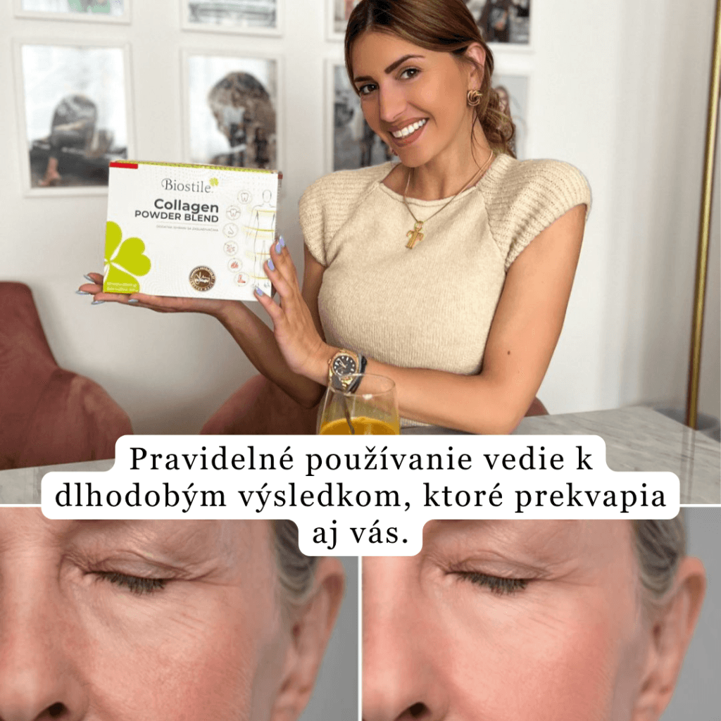 brand collagen s hialuronsko kislino darilo shaker mladosten videz lp 1