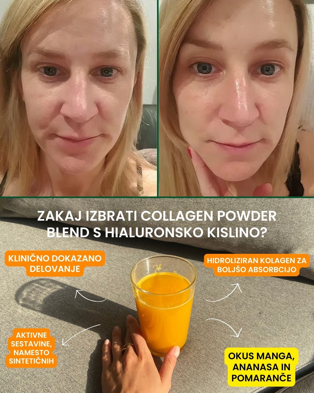 Collagen Powder + Hyaluronic acid, 30 vrečk
